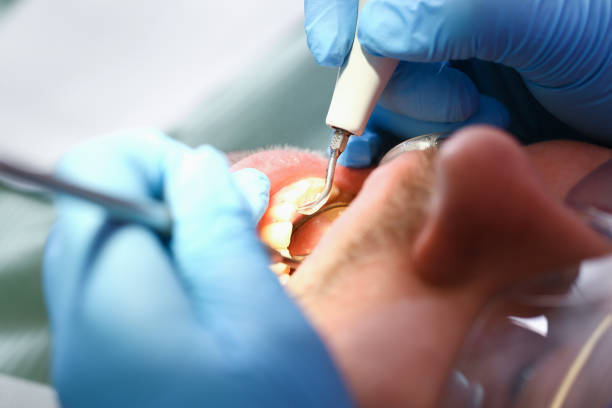 Best Emergency Gum Treatment in Island City, OR