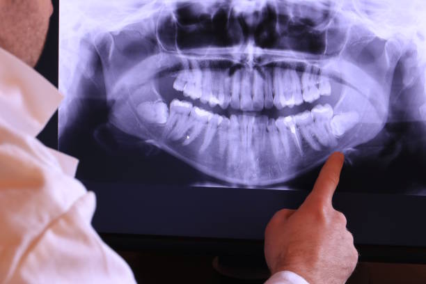 Best Emergency Treatment for Dental Infections or Abscesses in Island City, OR