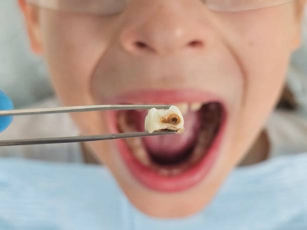 Best Urgent Care for Lost Fillings or Crowns in Island City, OR